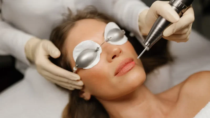 Luminous Skin Goals with Professional Pigmentation Lasers