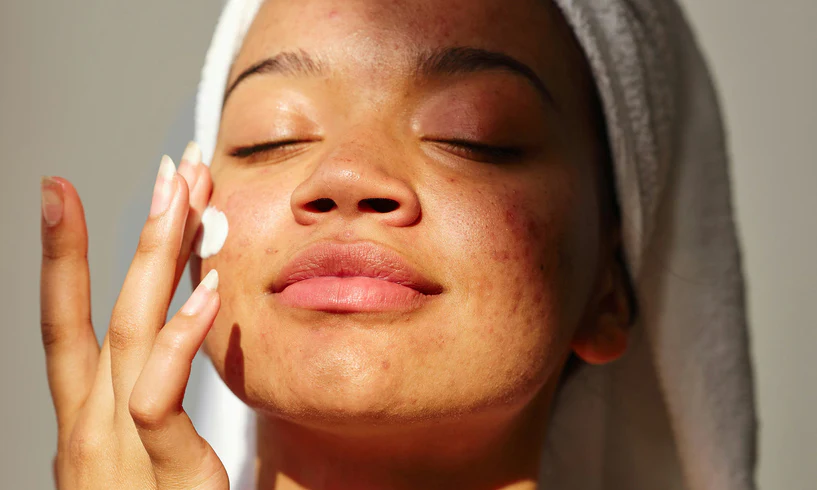 Soft, Healthy Skin with Nourishing Eczema Relief Methods